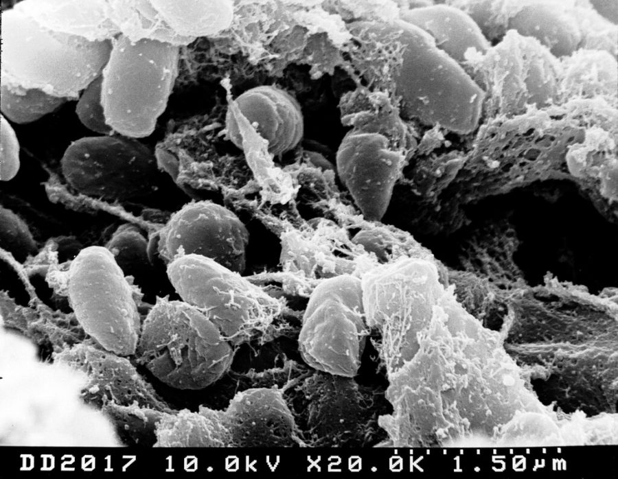 Credit:Ê Rocky Mountain Laboratories, NIAID, NIH   Scanning electron micrograph depicting a mass of Yersinia pestis bacteria (the cause of bubonic plague) in the foregut of the flea vector
